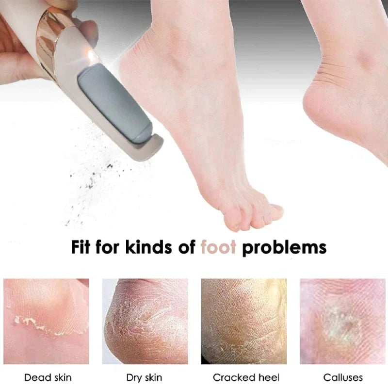 Rechargeable Electric Foot File 