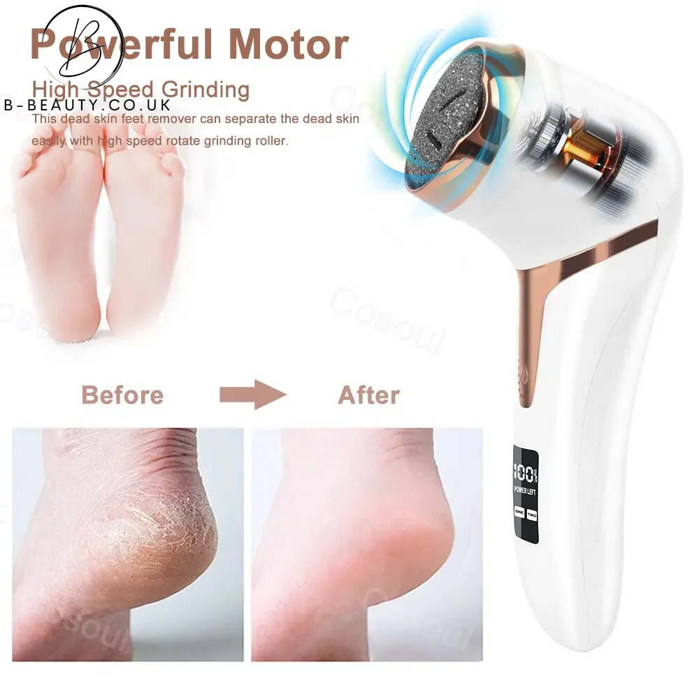 B-Beauty Professional Electric Dead Skin Remover / Exfoliating Callus Remover for Feet & Heels